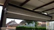 2. Garázskapu redőny 77 mm-es lamellákkal - antracit szürke